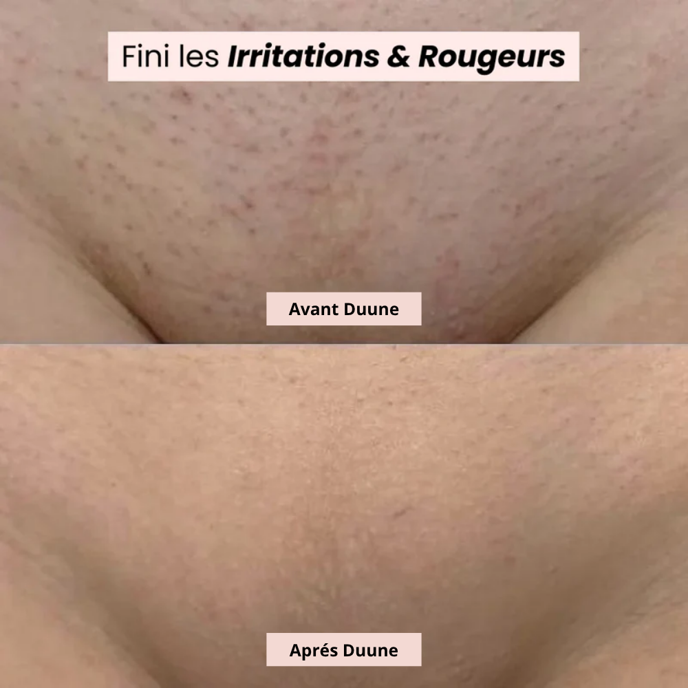 Coffret – Le Rasoir 2-en-1 pour peaux sensibles